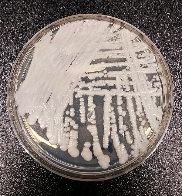 美国微生物学会年会2019：“超级真菌”遇到对手了